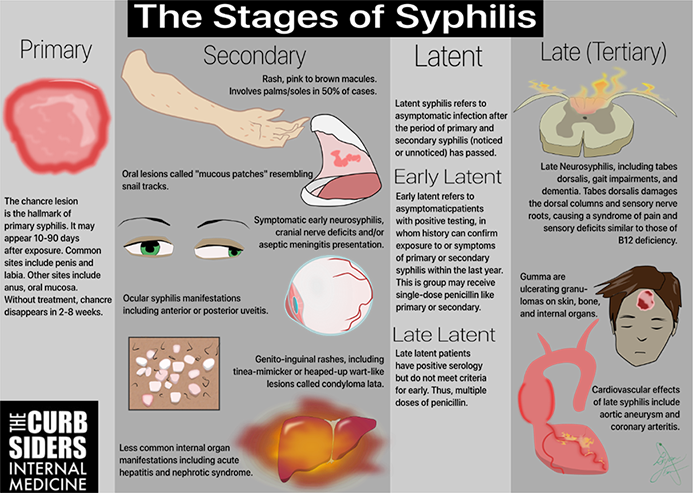 Pada Stadium Yang Berat Penyakit Sifilis Dapat Mengakibatkan - Homecare24
