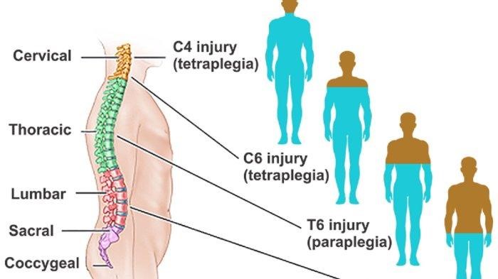 spinal2